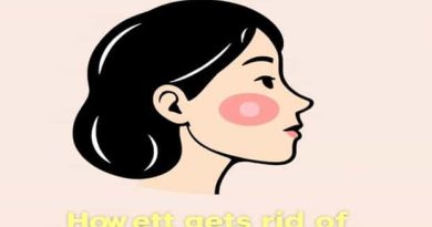 How To Get Rid Of Cheek Chubbiness