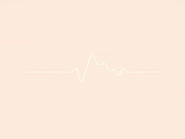 Meaning Of T Wave Abnormality