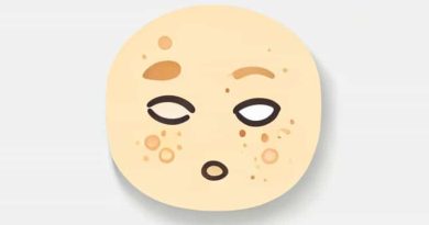 Excessive Amount Of Sebum Is Called