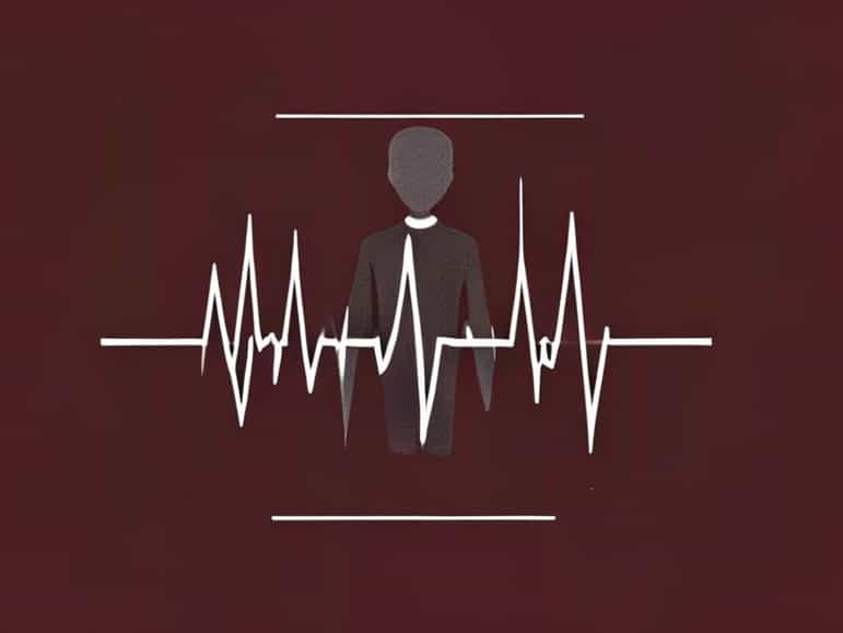 Frank Is Having A Rhythm Electrocardiography