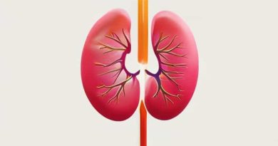 Icd 10 Calculus Of Kidney And Ureter