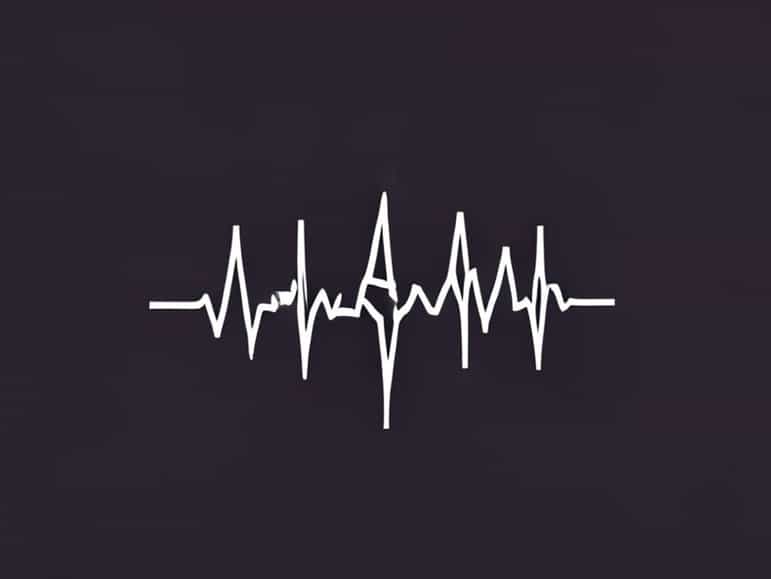 Mastering Electrocardiography And Arrhythmia Disorders 2024