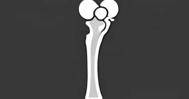 New Treatments For Osteoarthritis Of The Knee