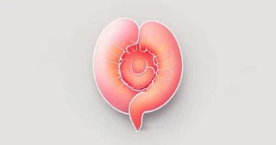 Ovarian Cyst After Hysterectomy