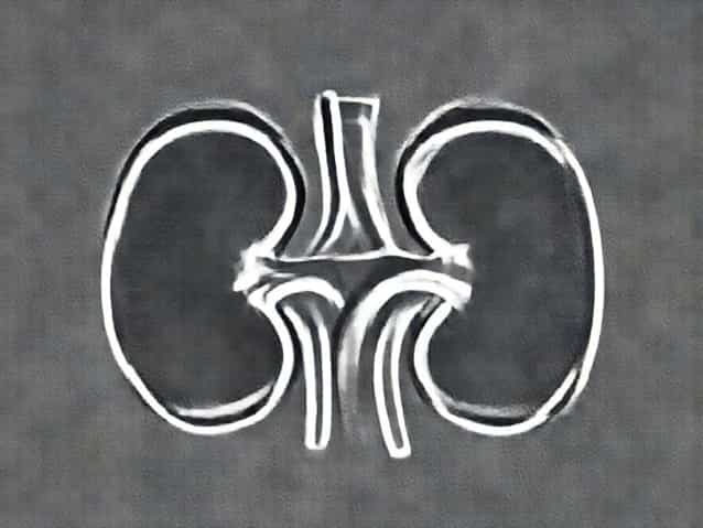 Bilateral Renal Calcareous Deposit In Hindi