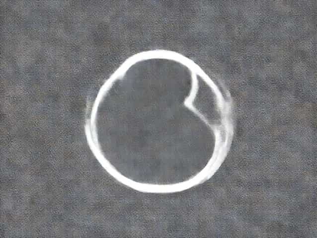 Blank And Blank Necessary For Childbearing