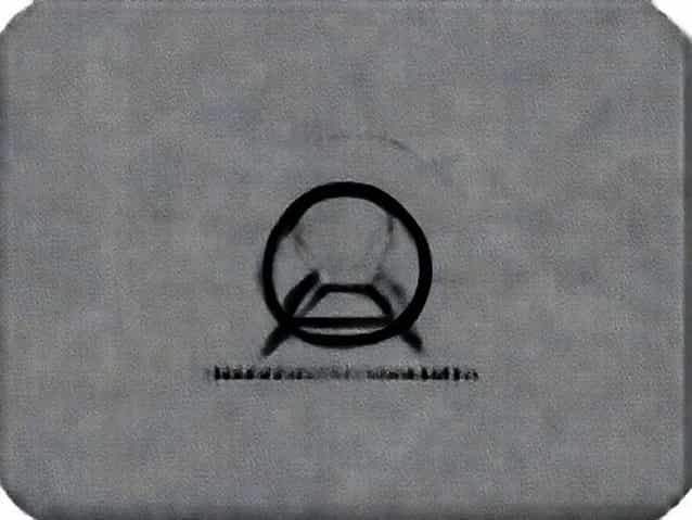 Case Study On Obsessive Compulsive Disorder