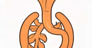 Gastroesophageal Reflux Dz W/O Esophagitis