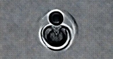 Life Threatening Dermatological Conditions