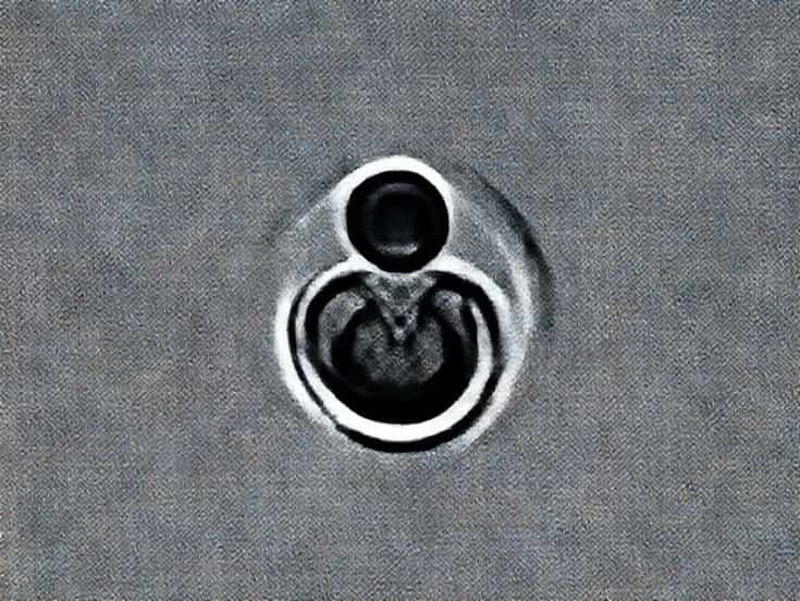 Life Threatening Dermatological Conditions