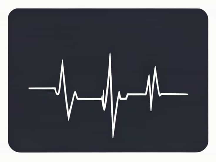 On An Ecg Atrial Systole Begins During The