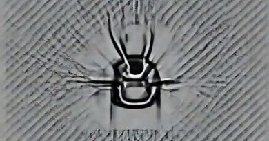 Vascular Surgery Residency Competitiveness