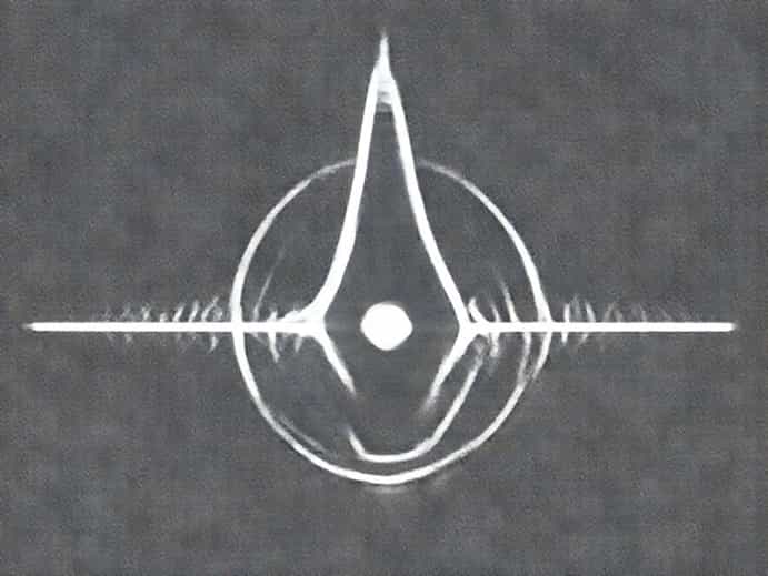 Ventricular End Diastolic Volume Is Called