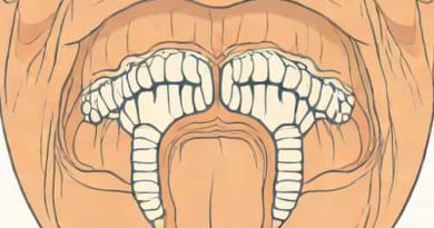 Boundaries Of Maxillary Sinus