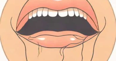 Facial Nerve Innervate Tongue