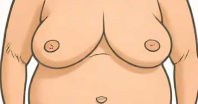Fat Necrosis After Mastectomy