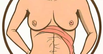 Is Mastectomy A Major Surgery