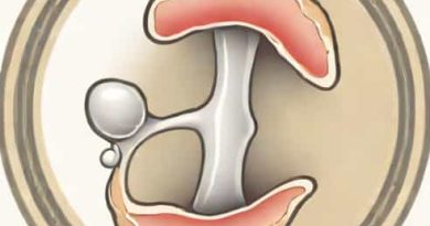Location Of Hyaline Cartilage