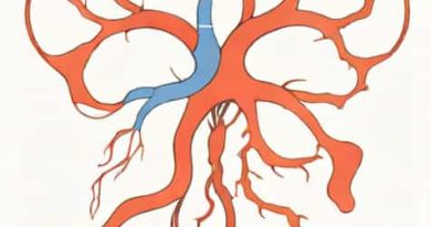 Total Venous Anomalous Return