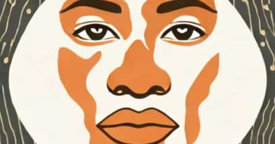 Vitiligo Extent Tensity Index