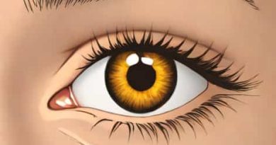 Xanthelasma Excision Cpt Code