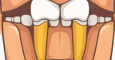 Teeth That Exhibit Pulpal Obliteration Quizlet